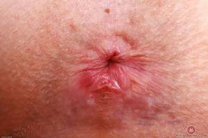 Original 3000 px/ 2000 px