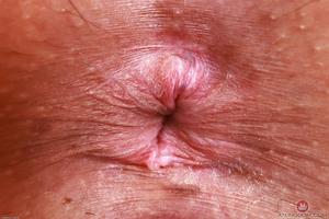 Original 3000 px/ 2000 px