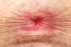 Original 3000 px/ 2000 px