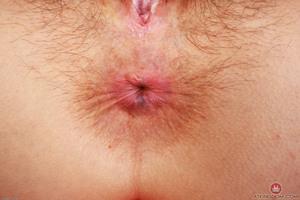 Original 3000 px/ 2001 px