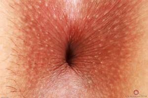 Original 3000 px/ 2000 px