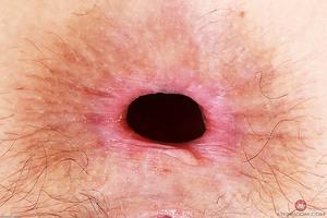 Original 3000 px/ 1999 px