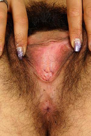 Original 860 px/ 1280 px