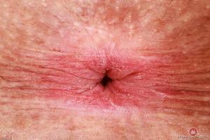 Original 3000 px/ 2000 px