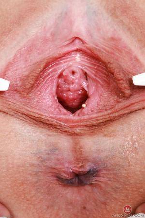 Original 2000 px/ 3000 px