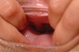 Original 2000 px/ 1328 px