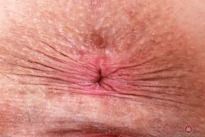 Original 3000 px/ 2000 px