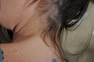 Original 3000 px/ 1996 px