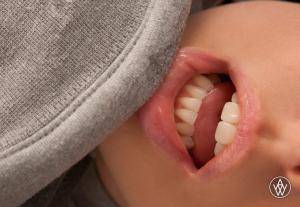 Original 2304 px/ 1595 px