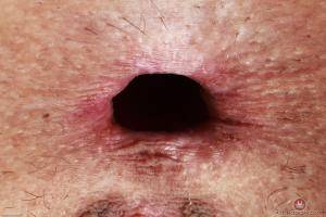 Original 3000 px/ 2000 px