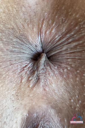 Original 2000 px/ 3000 px