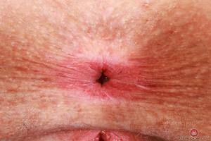 Original 3000 px/ 2000 px