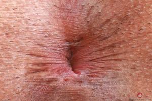 Original 3000 px/ 1999 px