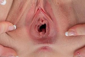 Original 3000 px/ 2001 px