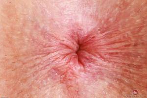 Original 3000 px/ 2000 px