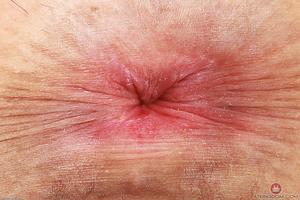 Original 3000 px/ 1999 px