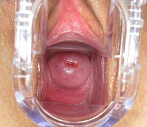 Original 2200 px/ 1900 px