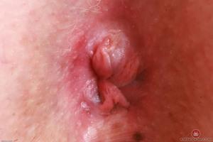 Original 3000 px/ 2000 px