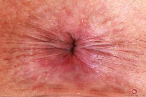 Original 3000 px/ 2000 px