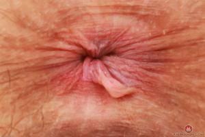 Original 3000 px/ 2000 px