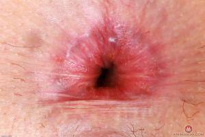 Original 3000 px/ 2000 px