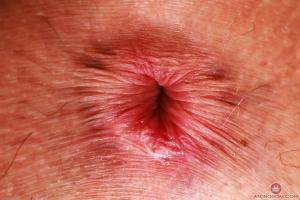 Original 3000 px/ 2000 px