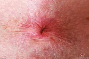 Original 3000 px/ 2000 px