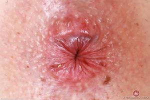 Original 5000 px/ 3332 px