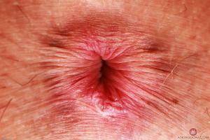 Original 3000 px/ 2000 px