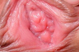 Original 3500 px/ 2333 px