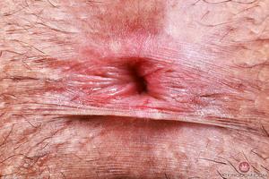 Original 5000 px/ 3333 px