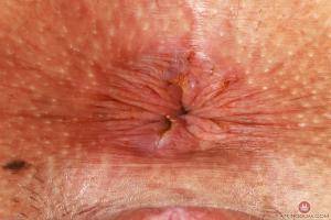 Original 3000 px/ 2000 px