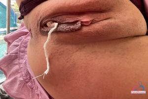 Original 3000 px/ 2000 px