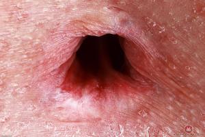 Original 3000 px/ 2001 px