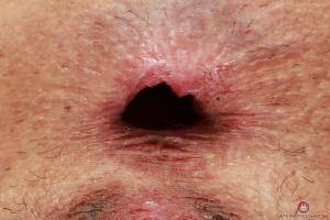 Original 3000 px/ 2000 px