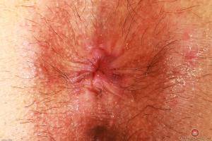 Original 3000 px/ 2000 px