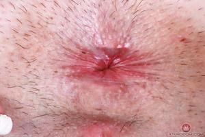 Original 5000 px/ 3333 px