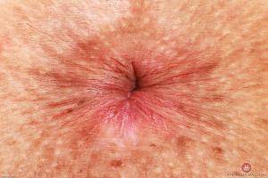 Original 3000 px/ 2000 px