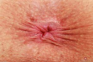 Original 3000 px/ 2000 px