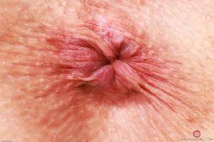 Original 3000 px/ 2000 px