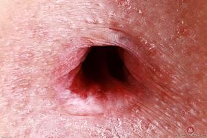 Original 3000 px/ 2000 px