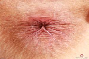 Original 3000 px/ 2000 px