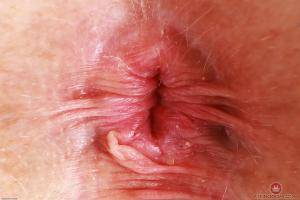 Original 3000 px/ 2000 px