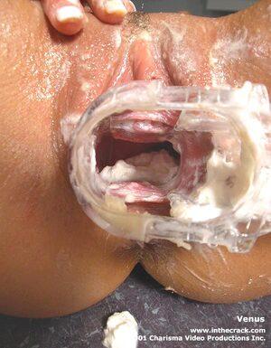 Original 599 px/ 768 px