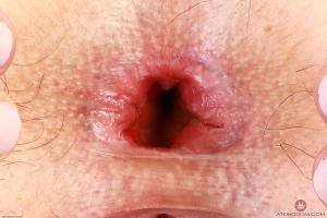 Original 3000 px/ 2000 px