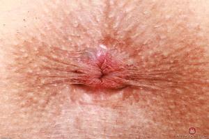 Original 3000 px/ 2000 px