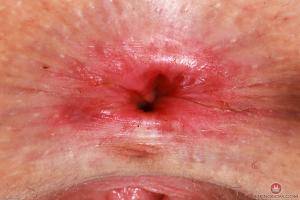 Original 3000 px/ 2000 px