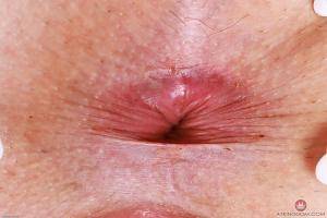 Original 3000 px/ 2000 px