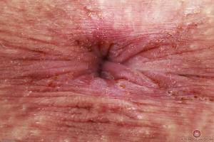 Original 3000 px/ 2000 px