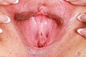 Original 3000 px/ 2000 px